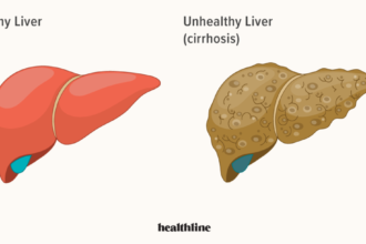 liver diseases