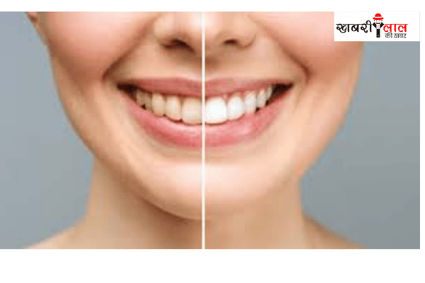 sensitive teeth