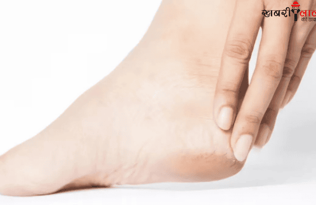 Cracked Heels |Home Remedies | Treatment | Dry Feet | Foot Care
