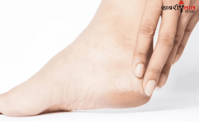 Cracked Heels |Home Remedies | Treatment | Dry Feet | Foot Care