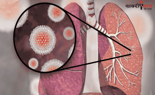 Hepatitis A | PDAP1 Protein | Liver Infection | Metabolic Imbalance