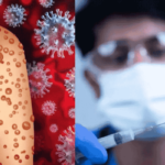 Mpox Virus | Men Health | Symptoms | Treatment | WHO Alert