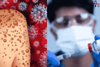 Mpox Virus | Men Health | Symptoms | Treatment | WHO Alert