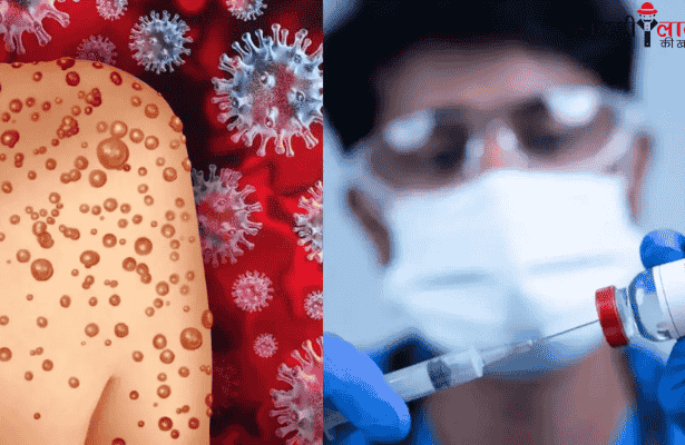 Mpox Virus | Men Health | Symptoms | Treatment | WHO Alert