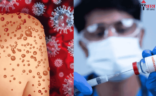 Mpox Virus | Men Health | Symptoms | Treatment | WHO Alert