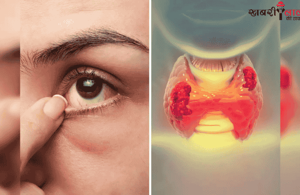 Thyroid | Eye Symptoms | Hyperthyroidism | Hypothyroidism
