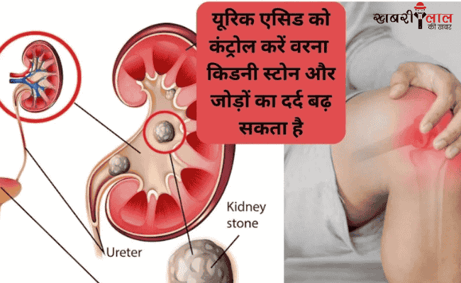 Ayurvedic Chutney | Uric Acid | Kidney Health | Natural Remedy