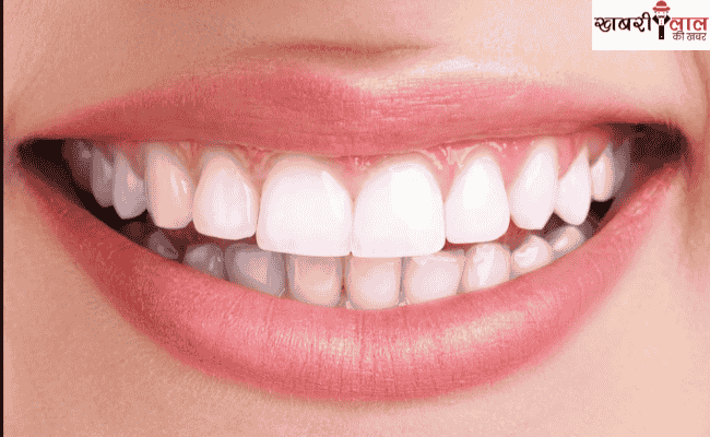 Karanji tree | Tooth Cavity | Pyorrhea | Ayurvedic Treatment